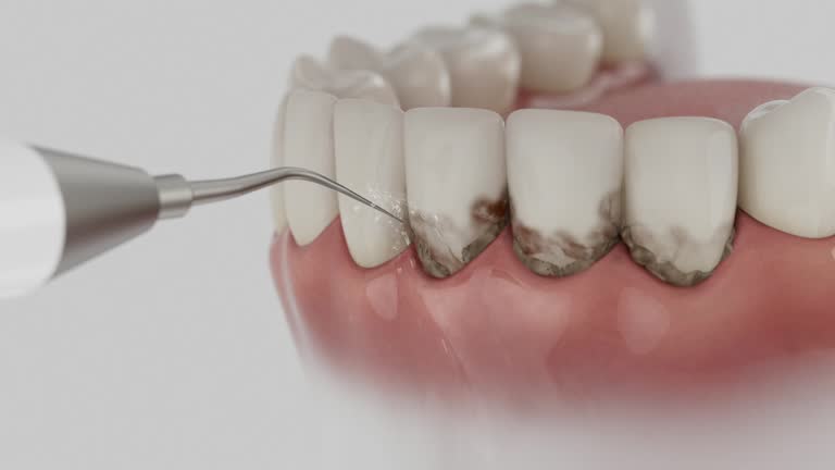 Trusted Teeth Cleaning And Checkup service in Drew, MS - Dentist Open Now